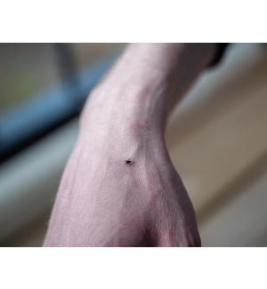 Borreliose